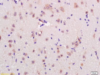 RNF123环指蛋白123抗体