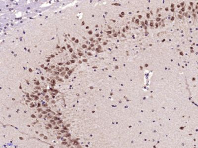 phospho-RPS6KB1(Ser417)磷酸化核糖体S