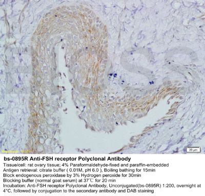 FSH receptor促卵泡刺激素受体抗体