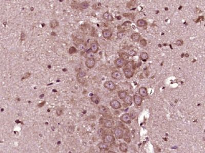 GSK-3 Beta糖原合酶激酶-3β抗体
