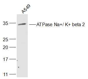 ATPase Na+/ K+ beta 2钠钾ATP酶通道蛋