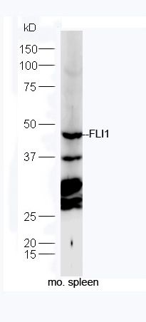 FLI1尤文肉瘤FLI1蛋白抗体
