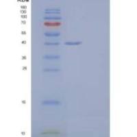 人果糖二磷酸醛缩酶C/醛酮重组蛋白C-6His