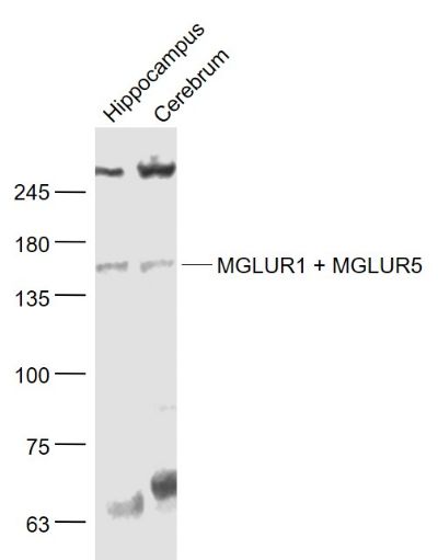 MGLUR1 + MGLUR5促代谢型谷氨酸受体1+5抗体
