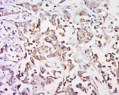 GPR91 G蛋白偶联受体GPR91蛋白抗体