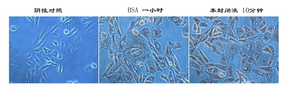 YT™免疫染色封闭液厂家