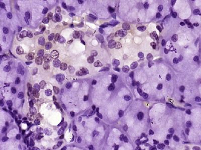 CCL26 Signal peptide antibody