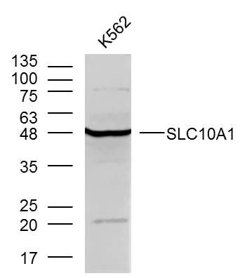 SLC10A1 antibody