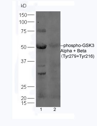 phospho-GSK3 Alpha + Beta (Tyr