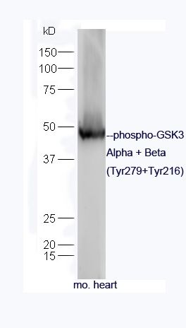 phospho-GSK3 Alpha + Beta (Tyr