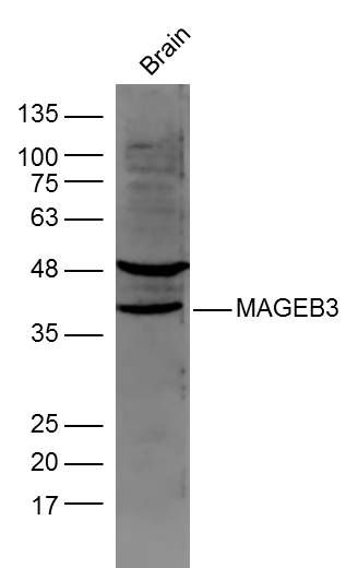 MAGEB3 antibody