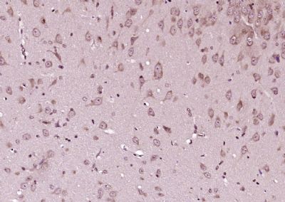 phospho-CDKN1B (Thr198)磷酸化P27