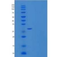 大鼠受体酪氨酸蛋白激酶ErbB-2重组蛋白