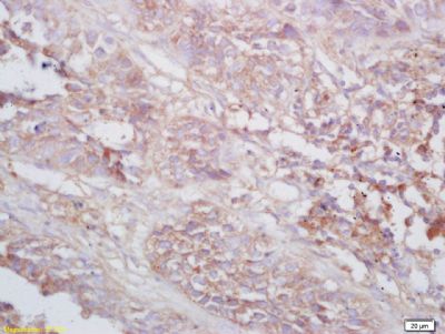 TNMD腱调蛋白/软骨调节素样1蛋白抗体