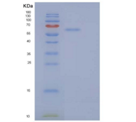 人分泌粒蛋白Ⅱ(SCG2)重组蛋白C-6His