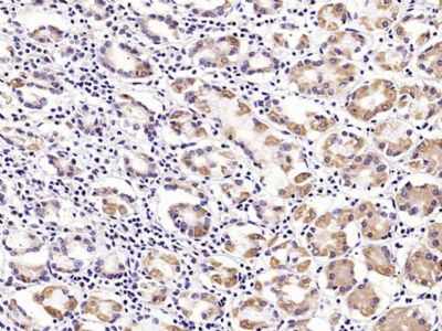 MUC5AC antibody