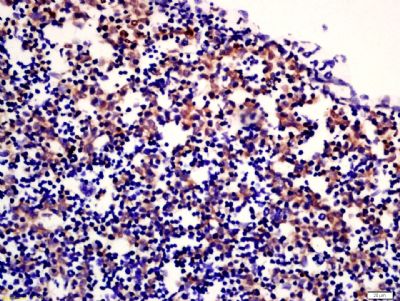 phospho-c-kit(Tyr936) antibody