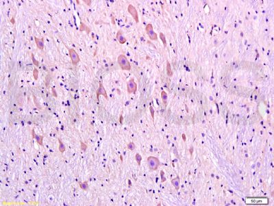Dopamine Receptor D1多巴胺受体D1抗体