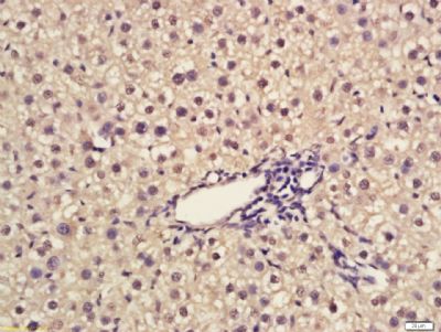 Egr1早期生长应答蛋白1靶向蛋白1抗体