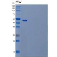 小鼠血管生成素样蛋白4(ANGPTL4)重组蛋白C-Fc