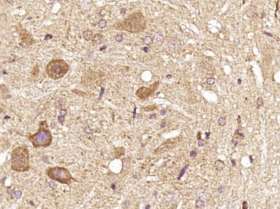 DGKA甘油二酯激酶α/DGK-α抗体