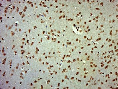 C-RAF/Raf-1 antibody