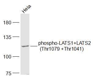 phospho-LATS1+LATS2 (Thr1079 +