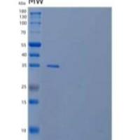 人视黄醇结合蛋白3重组蛋白N-6His