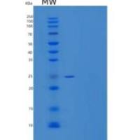 人叶酸受体α重组蛋白