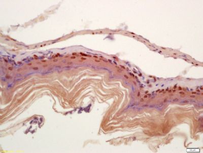 CIDEC细胞死亡活化蛋白抗体