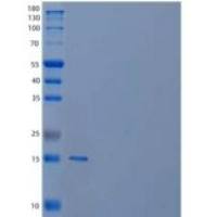 人类视黄醇结合蛋白7重组蛋白