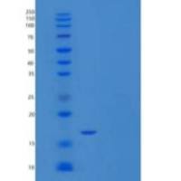 人dUTP焦磷酸酶dUTP酶重组蛋白