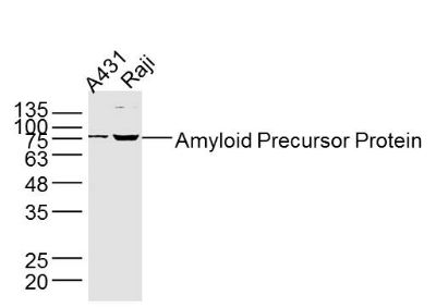 Amyloid Precursor Protein anti