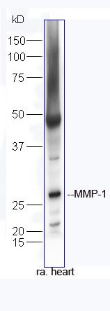 MMP1 antibody