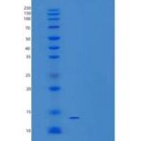 人磺基转移酶/SULT1C4/SULT1C2重组蛋白