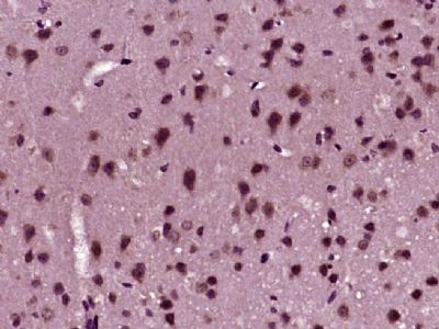 BASP1脑富含膜附着信号蛋白1抗体