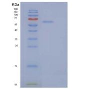 人分泌粒蛋白Ⅱ(SCG2)重组蛋白C-6His