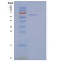 人分泌粒蛋白Ⅱ(SCG2)重组蛋白C-6His