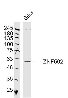 ZNF502锌指蛋白502抗体