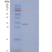 小鼠外生骨疣样蛋白2(EXTL2)重组蛋白N-6His