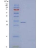 小鼠外生骨疣样蛋白2(EXTL2)重组蛋白N-6His