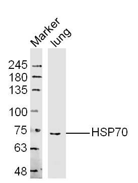 HSP70热休克蛋白70抗体