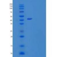 人n-乙酰神经氨酸合酶/NANS/SAS重组蛋白N-6His