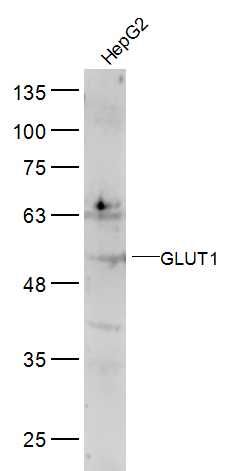 GLUT1葡萄糖转运蛋白1抗体