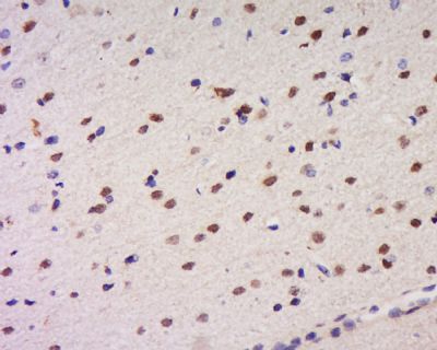 CCDC34 antibody