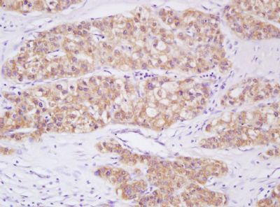 Phospho-Smad3 (Ser423 + Ser425