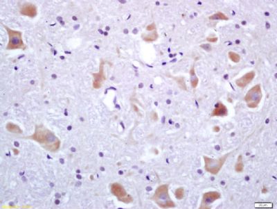 Phospho-IRF3 (Ser396) antibody