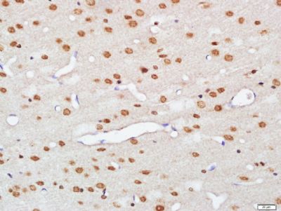 hnRNP M antibody