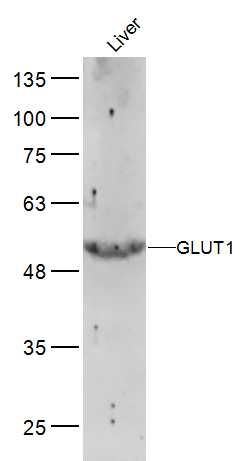 GLUT1葡萄糖转运蛋白1抗体