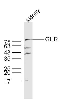 Growth hormone receptor antibo